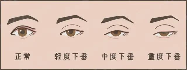 圖文圖片