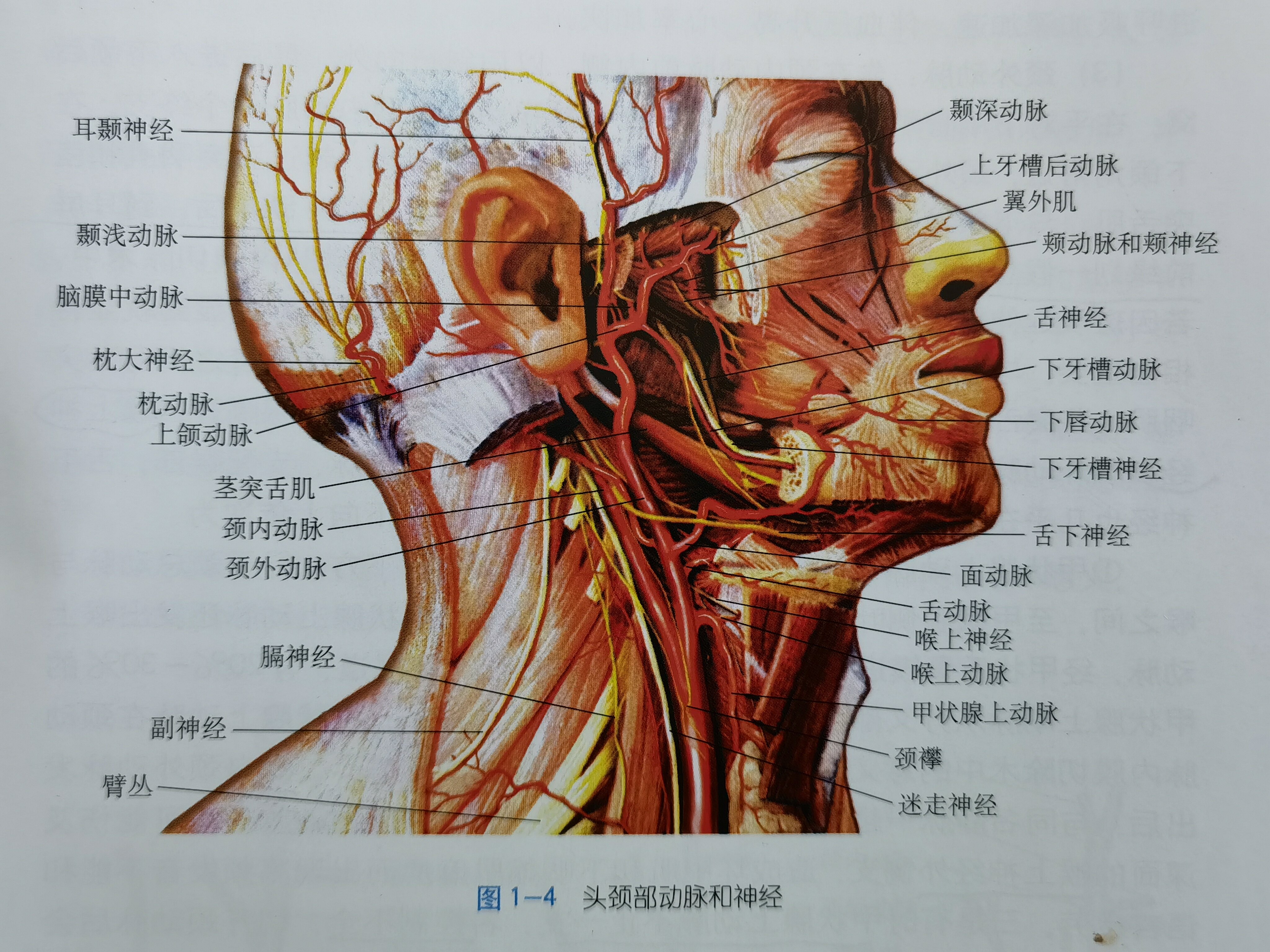 神经鞘瘤示意图图片