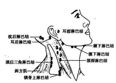 滑车上),大腿根(腹股沟),腿打弯的地方(腘窝)……都是浅表淋巴结的