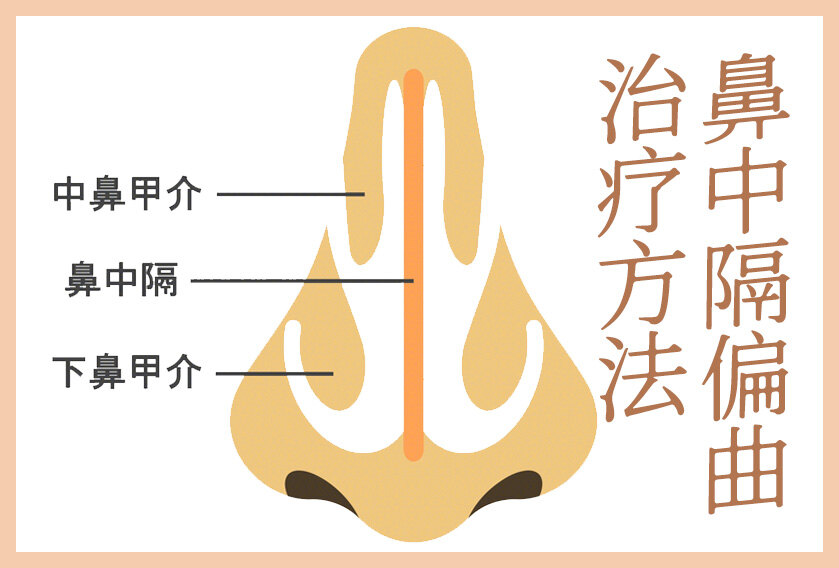 圖文圖片