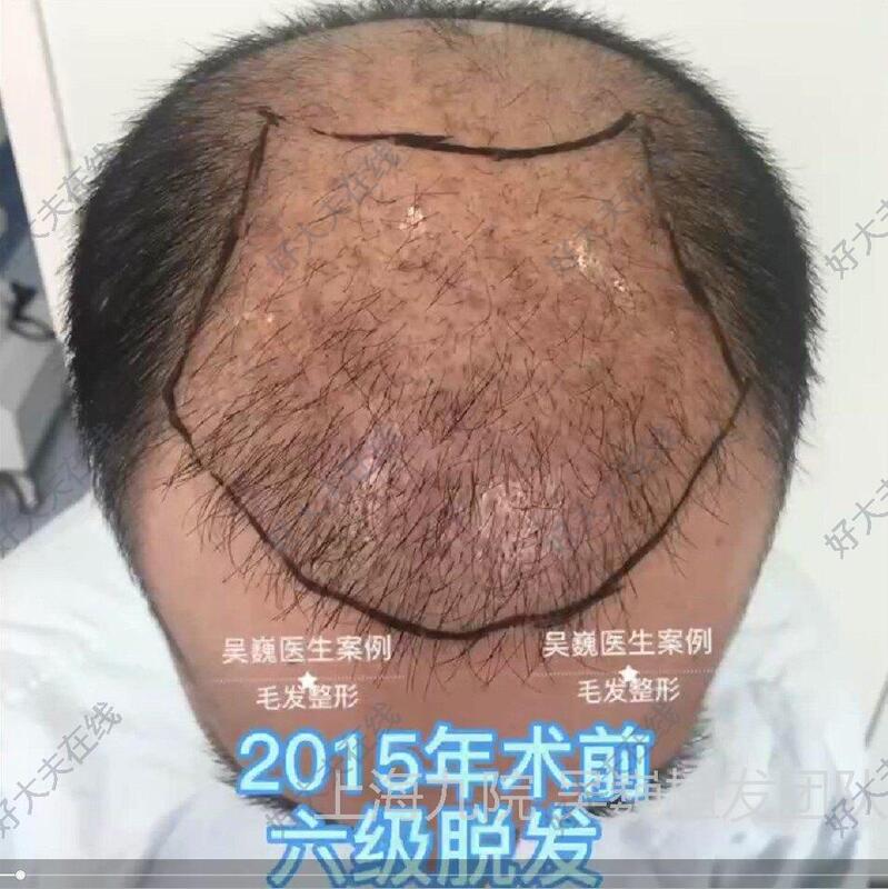 圖文圖片
