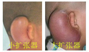 圖文圖片