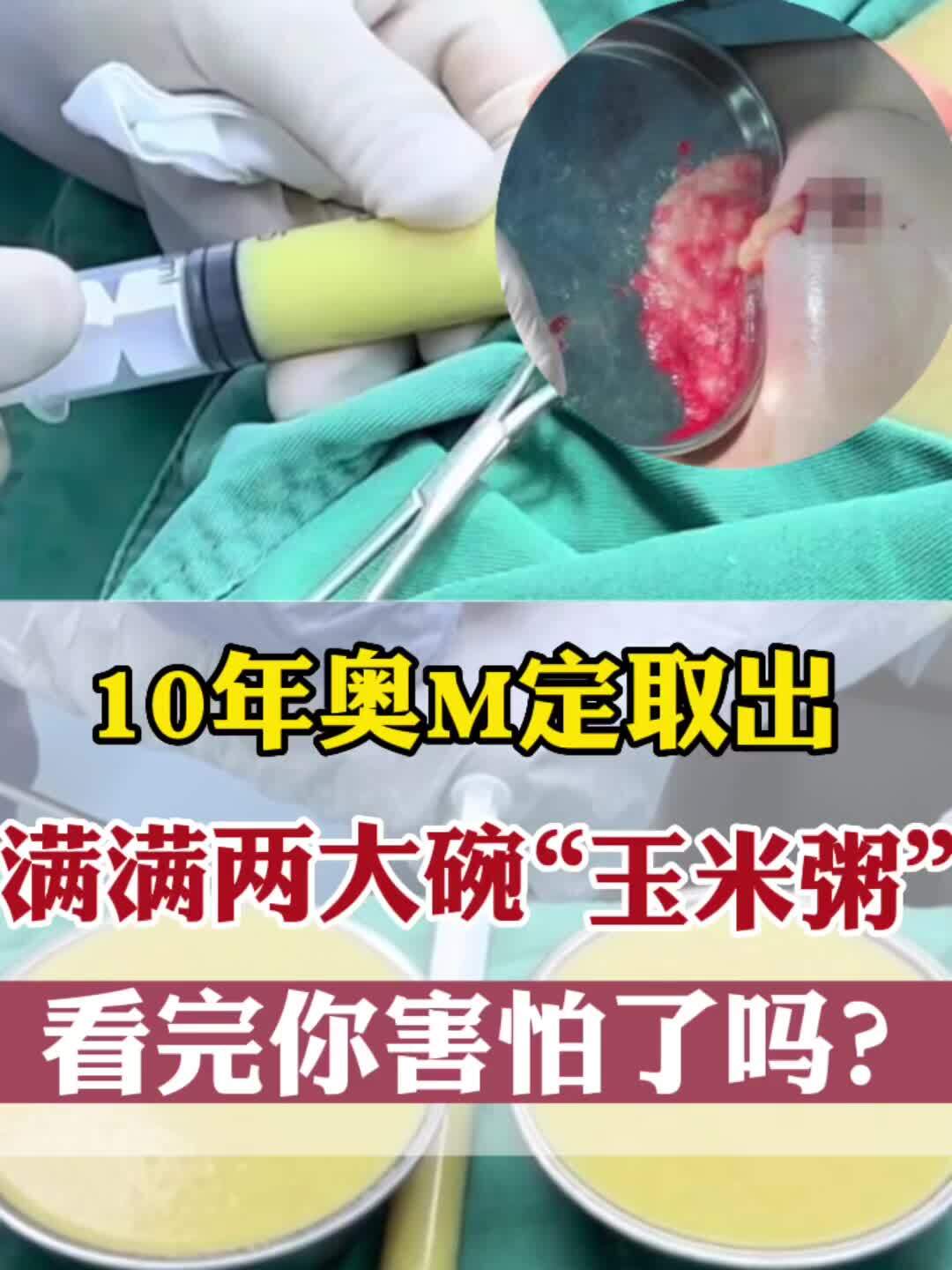 視頻封面