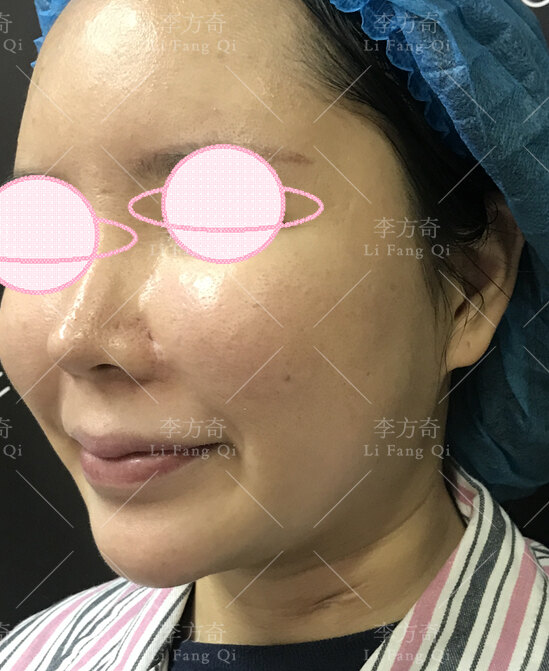 令人"毁容"的生长因子到底是什么?