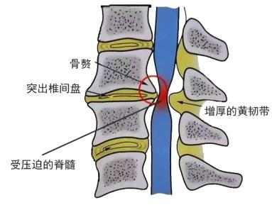 圖文圖片