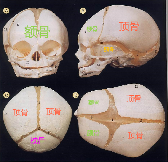 顱骨解剖米偉陽醫生顱縫早閉/狹顱症治療中心顱縫