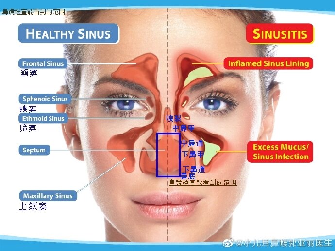 1-2-2鼻窦2.jpg