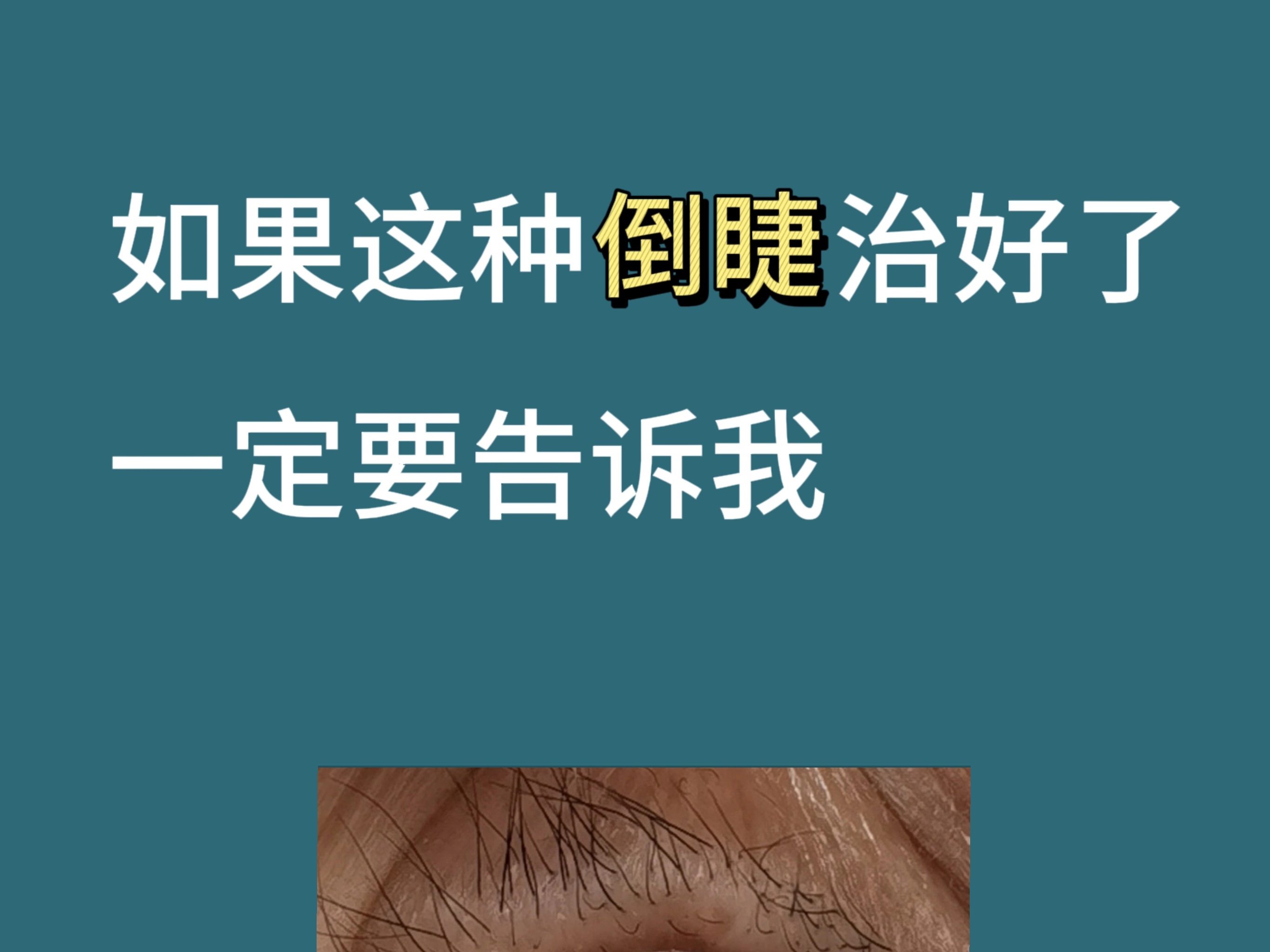 圖文圖片
