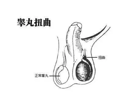 男人的阴囊部位外观图片
