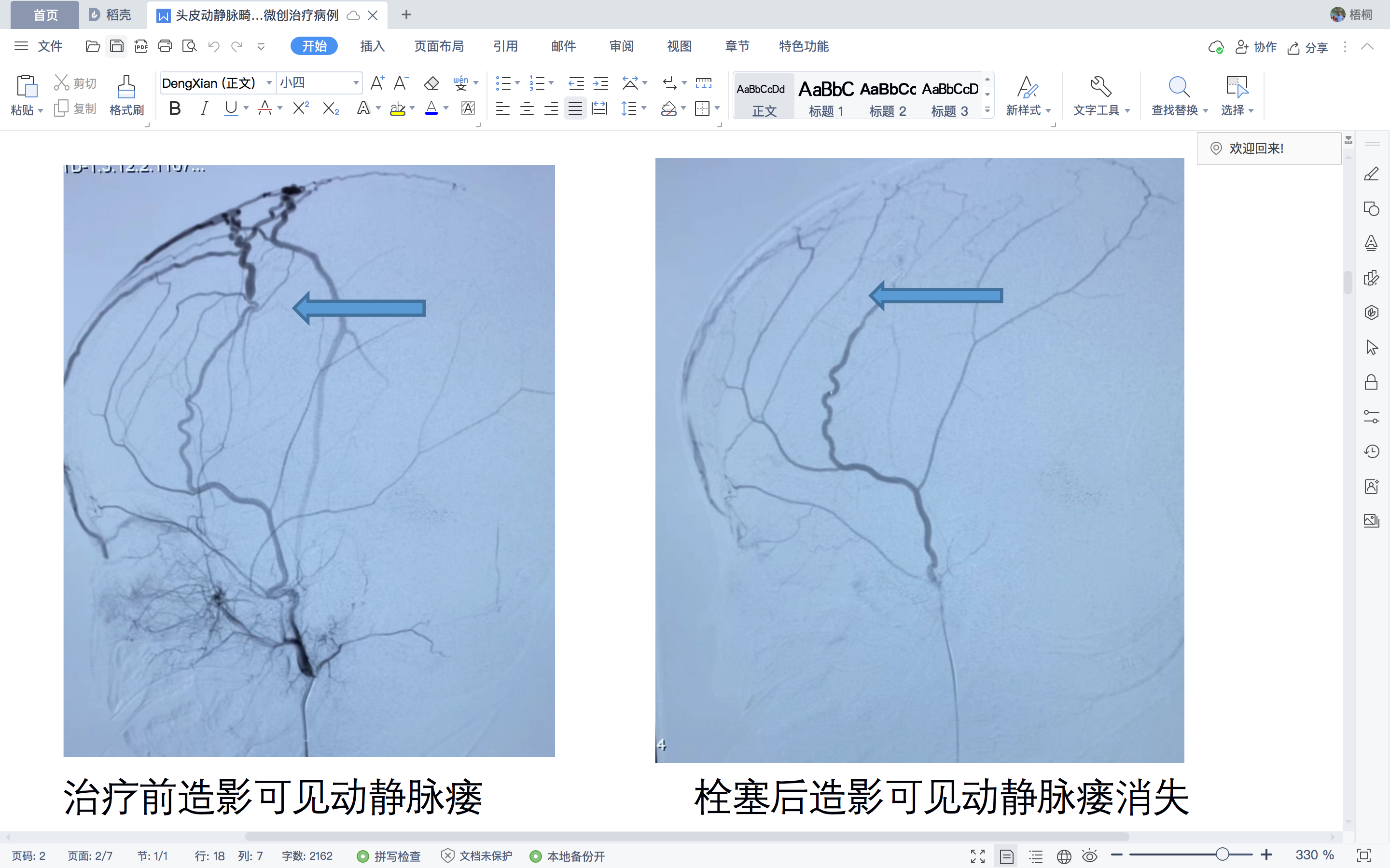 屏幕快照 2022-04-28 下午11.02.24.png