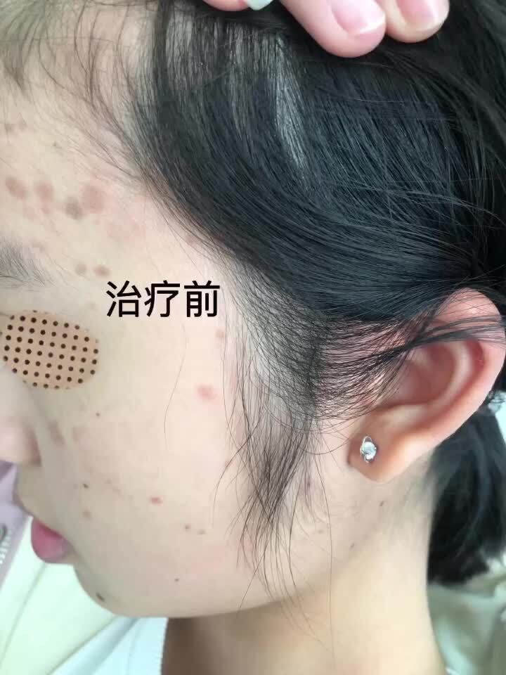 視頻封面