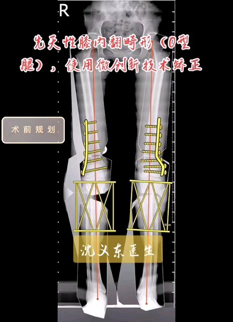 默认图片