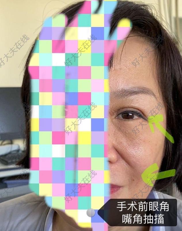 圖文圖片