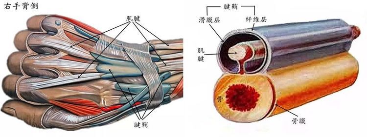 手腕腱鞘囊肿解剖图图片