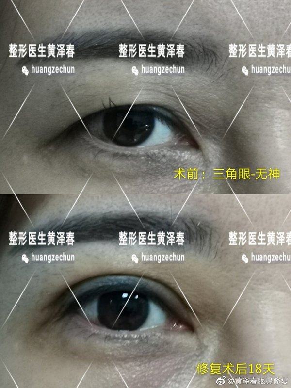 圖文圖片