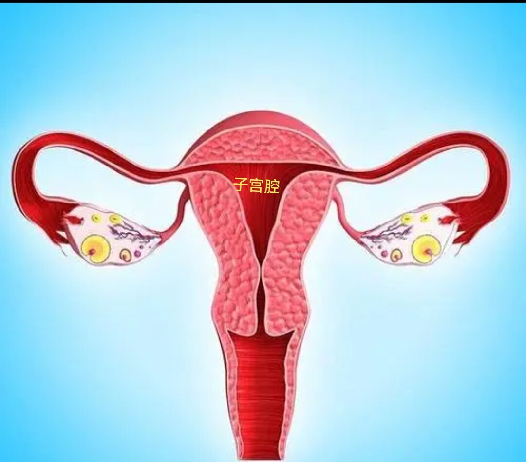 9,宫腔粘连不会癌变;8,宫腔粘连子宫内膜受损,导致子宫内膜薄,胚胎