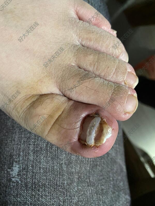 圖文圖片