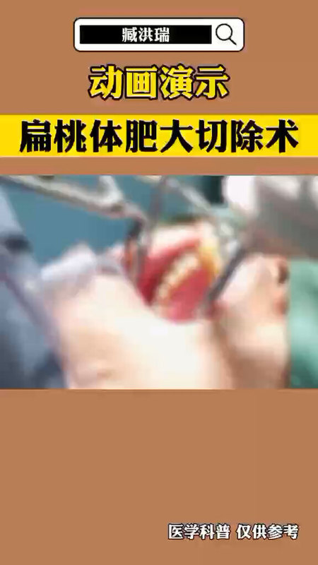 視頻封面