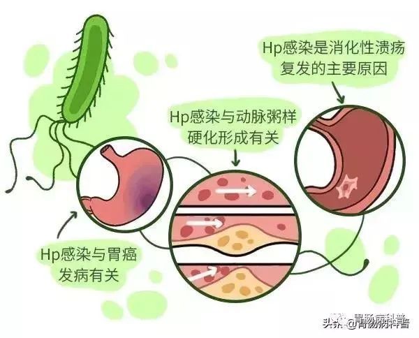 圖文圖片