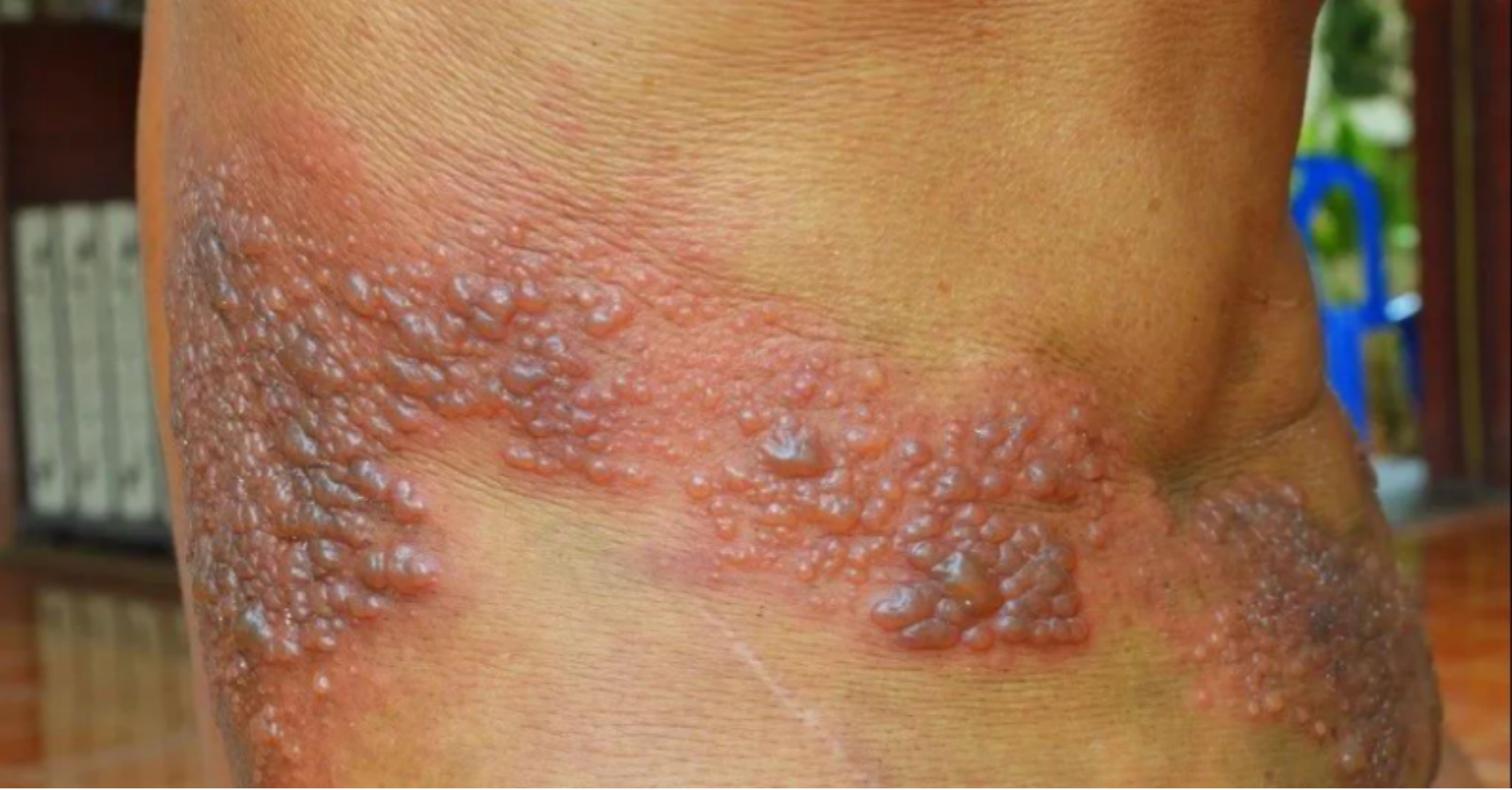 蛇缠腰缠满一圈就会死人是真的吗