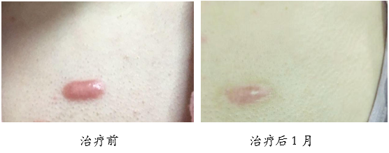 圖文圖片