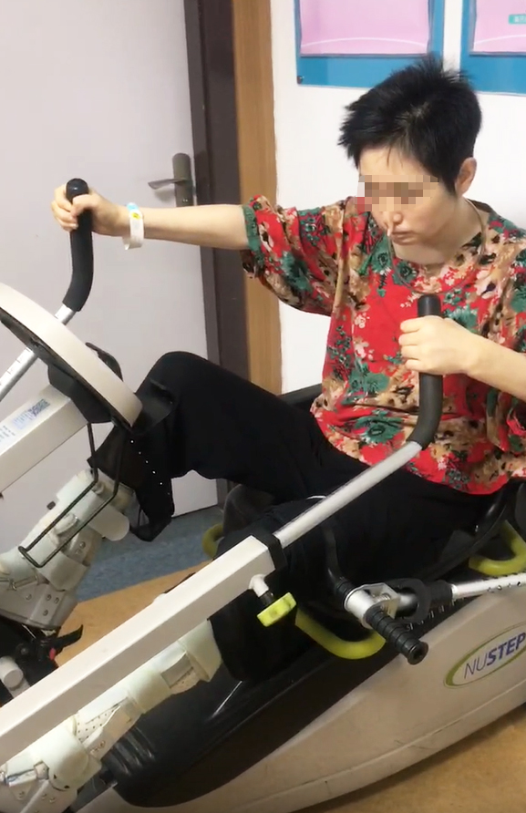 脑积水分流术后出现木僵,昏迷,芭蕾舞脚,反复调压和更换分流泵治疗均