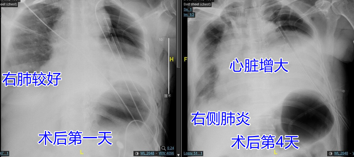 1+4床旁片水印.jpg