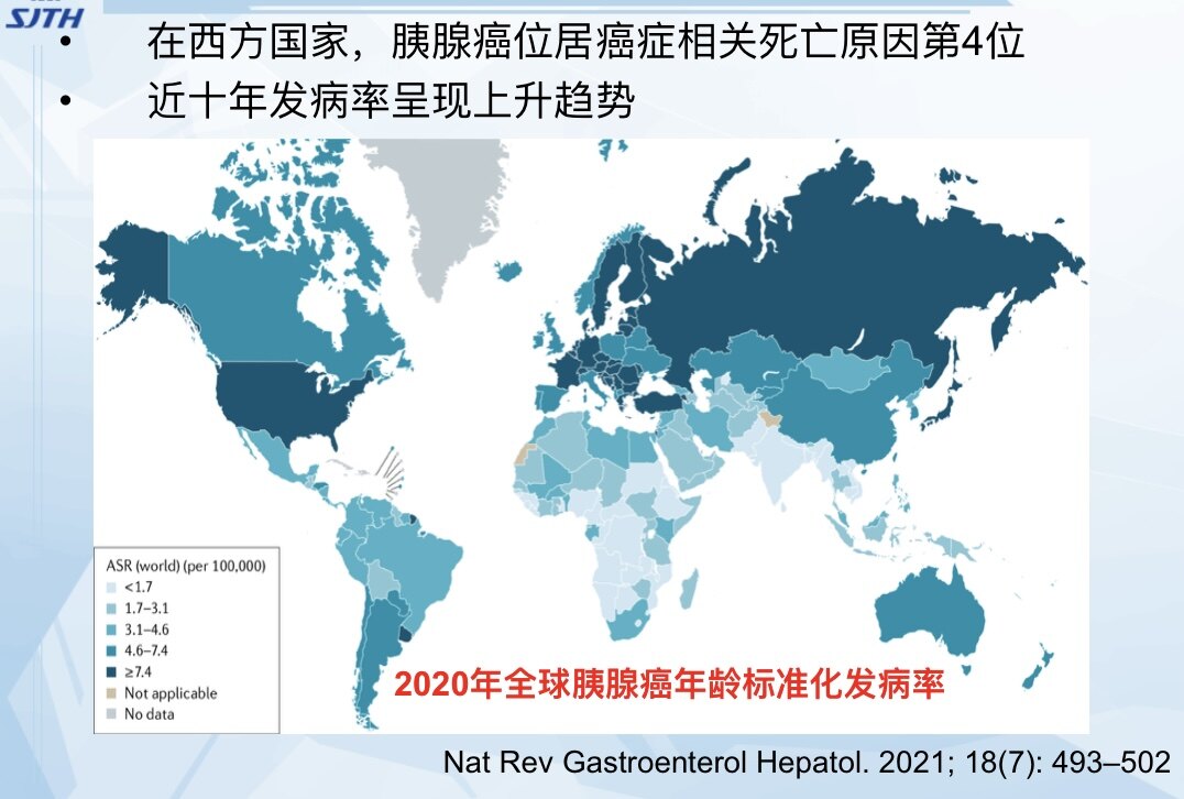 使用新方法 胰腺癌可以提前三年被诊断出来 