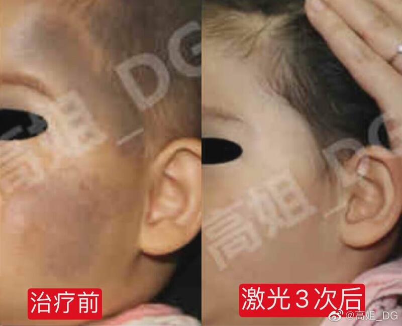圖文圖片