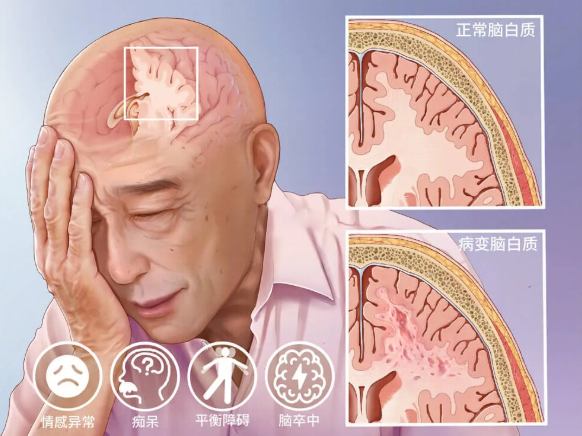 圖文圖片