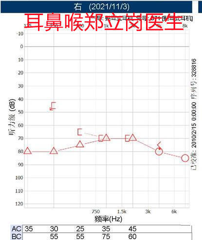 圖文圖片