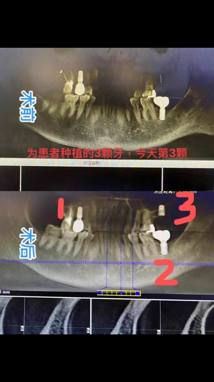 默认图片