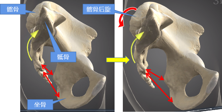 骶尾部痛与懒散坐姿