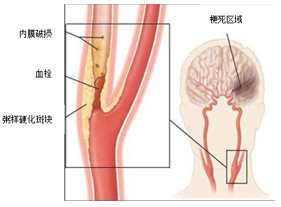 圖文圖片