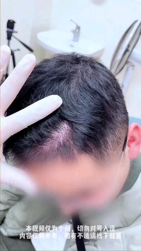 視頻封面