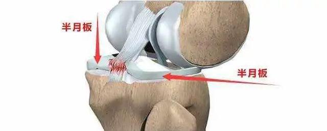 可引起前交叉韧带或是后交叉韧带的损伤.