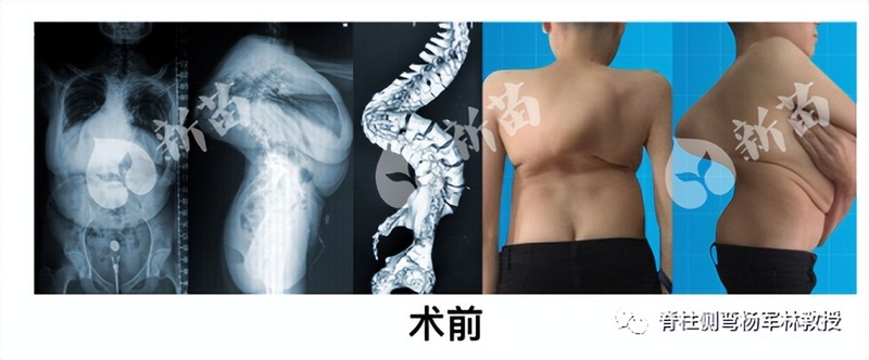 圖文圖片