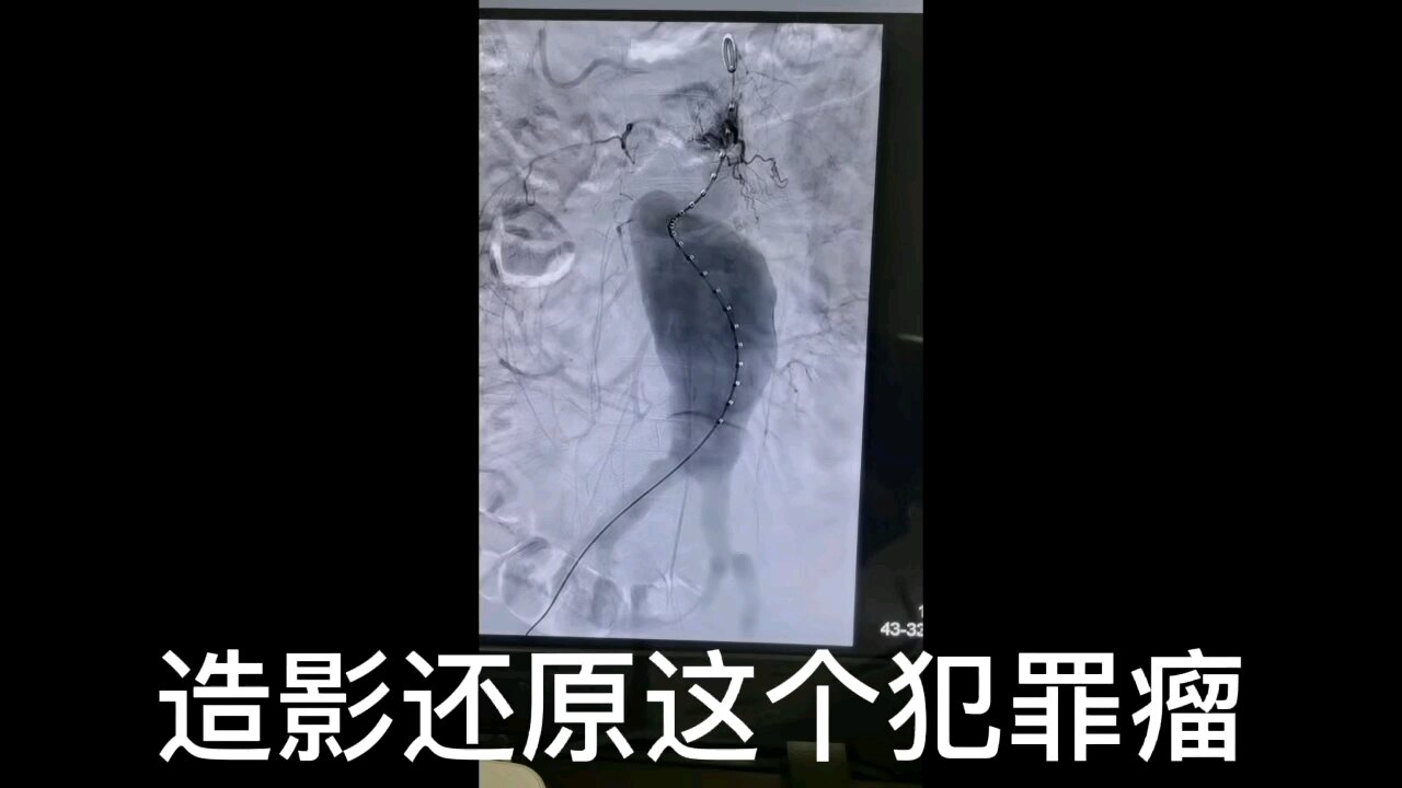 默认图片