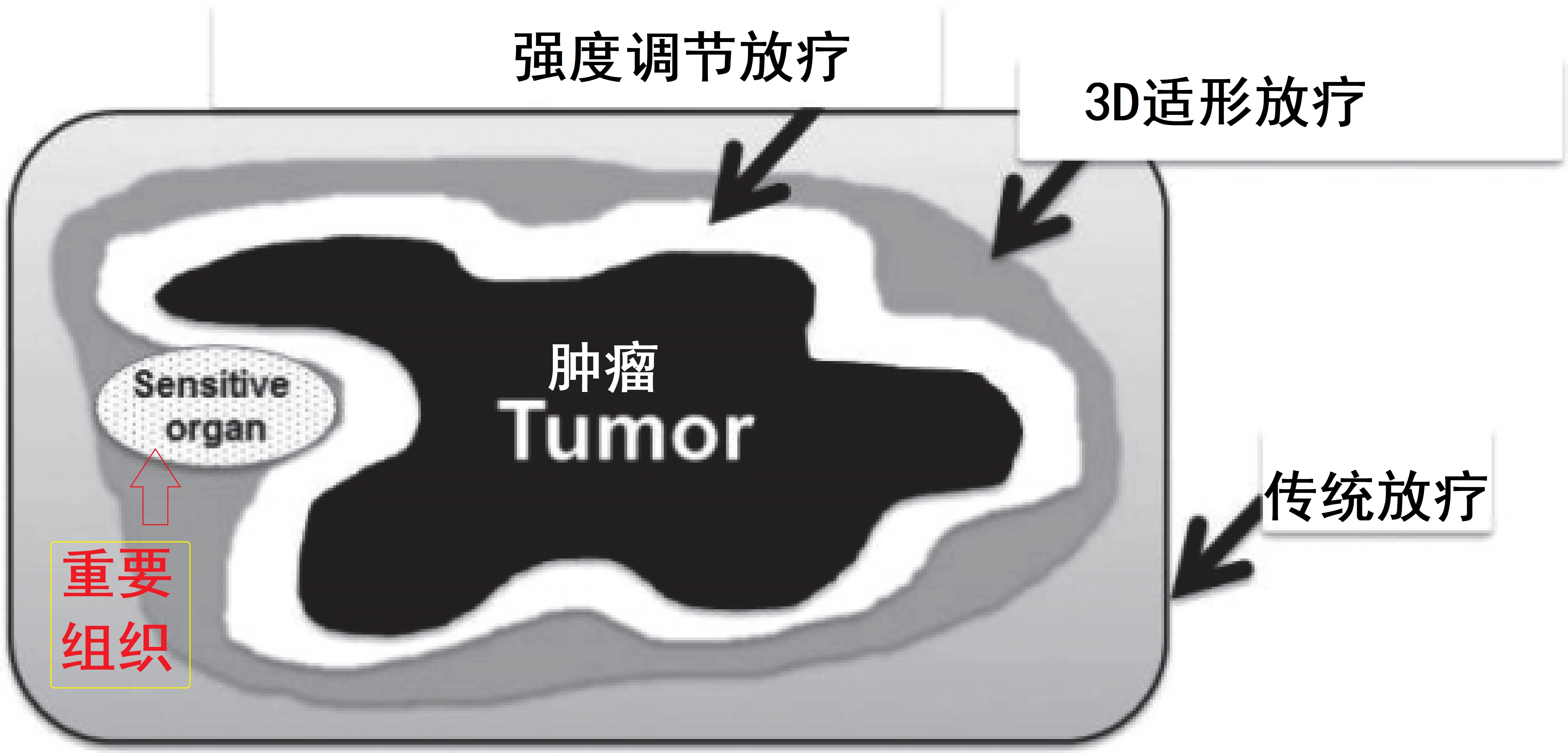 放疗的对比.jpg