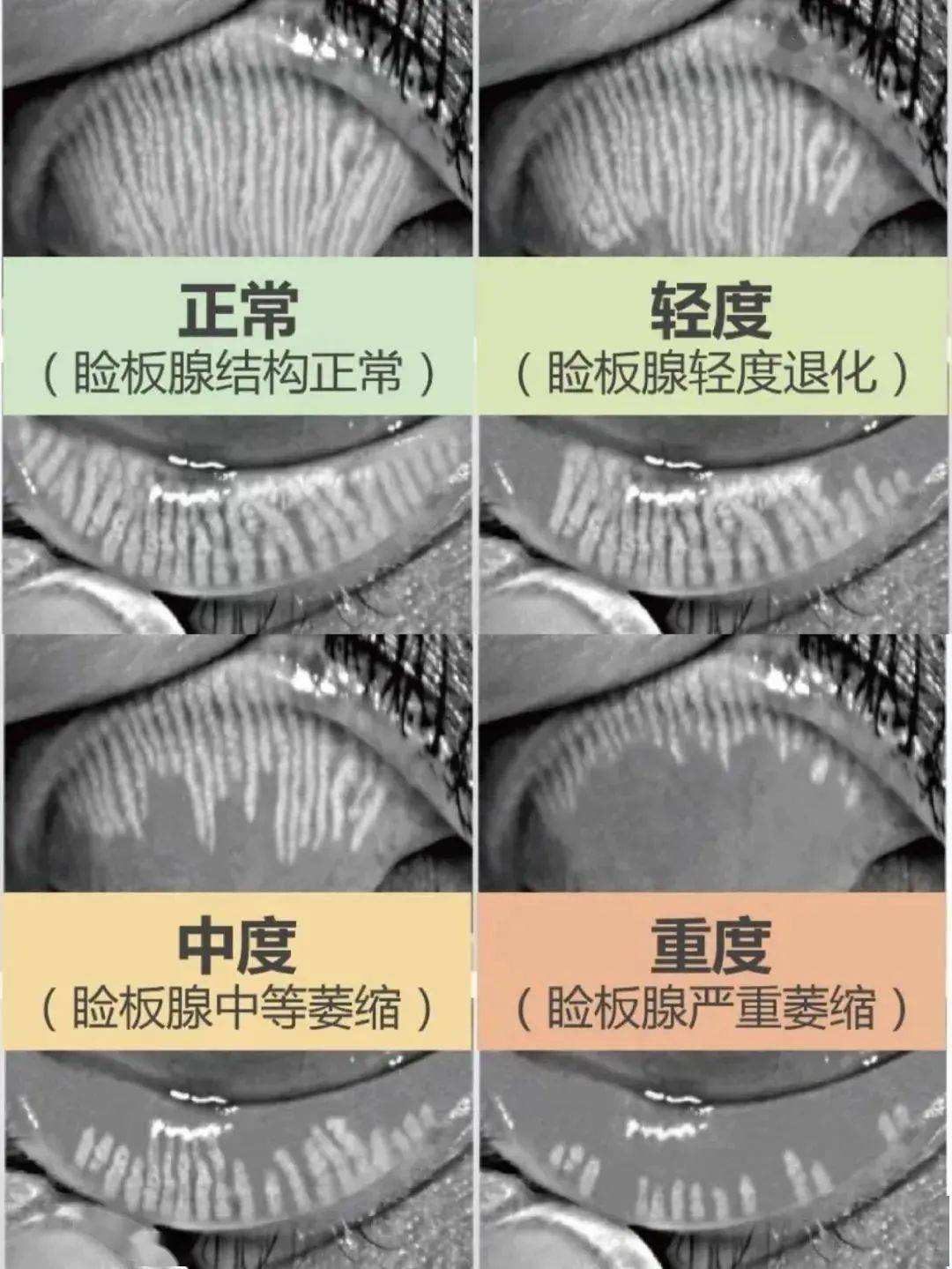 src=http___upload-images.jianshu.io_upload_images_26665485-a4599f8f5ffe4d20.jpg&refer=http___upload-images.jianshu.jpg