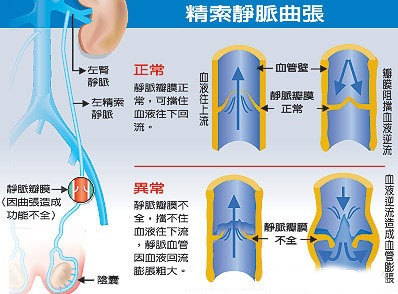 男人蛋疼是什么原因图片