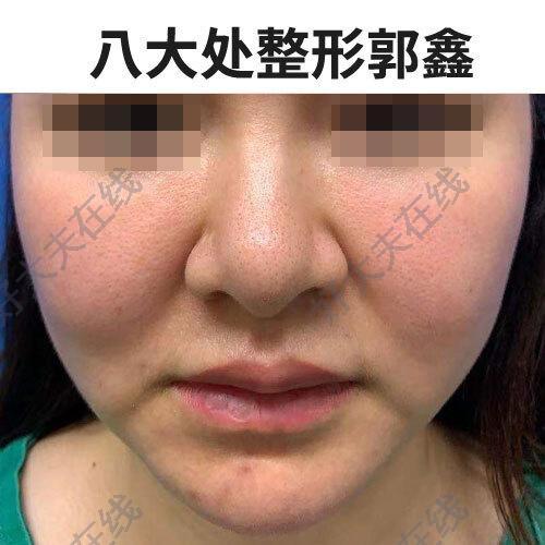 圖文圖片