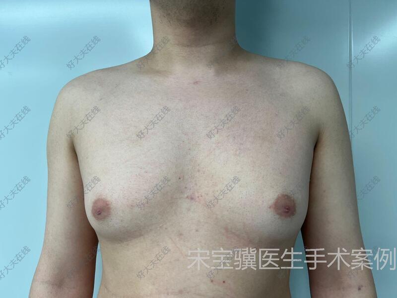 圖文圖片