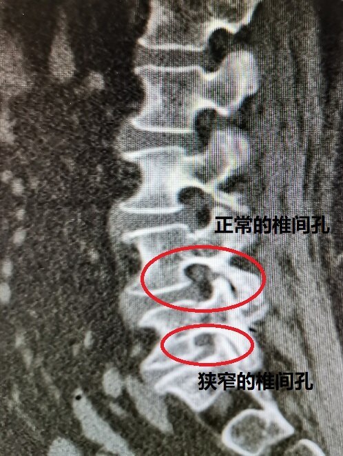 圖文圖片