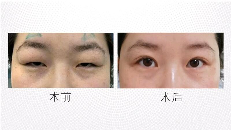 視頻封面