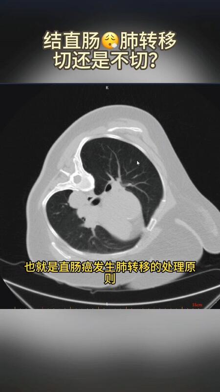 視頻封面