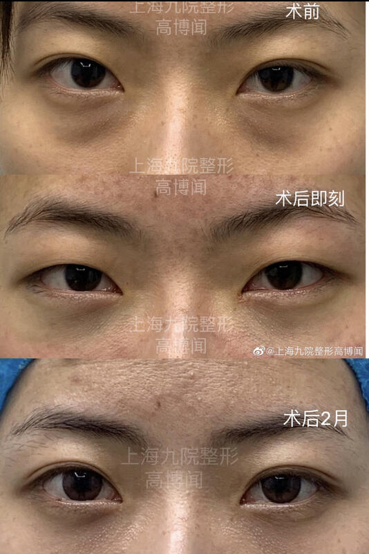 圖文圖片