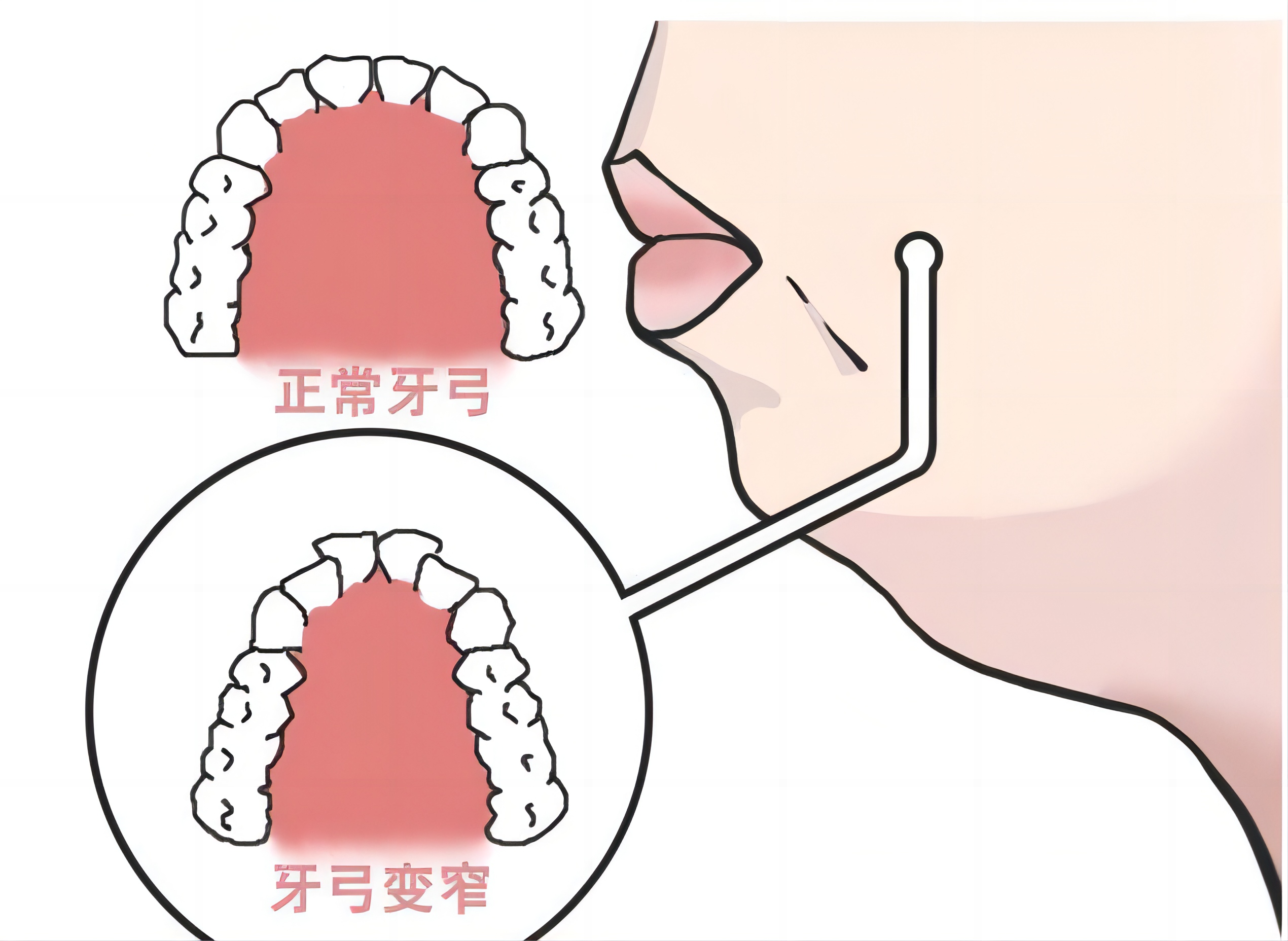 圖文圖片