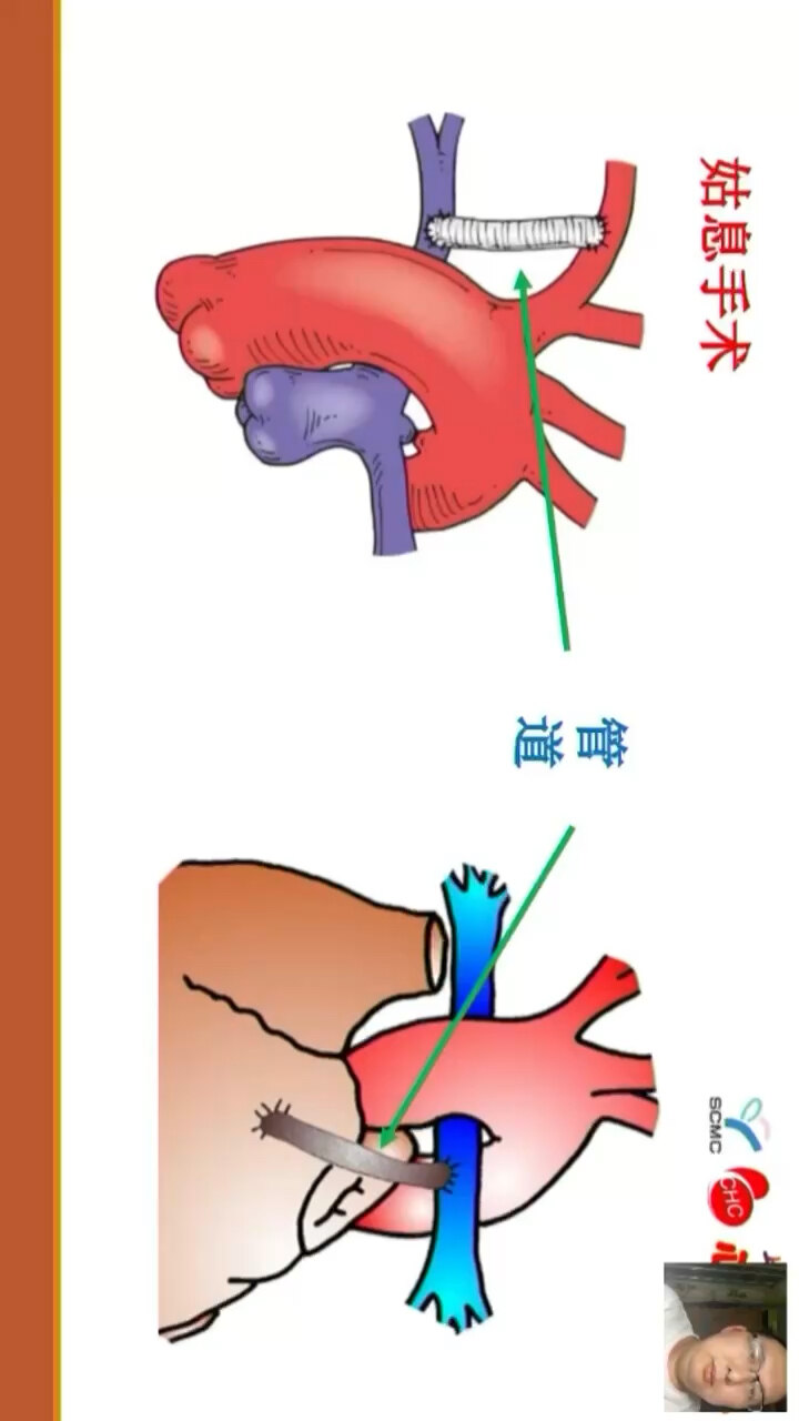 默认图片