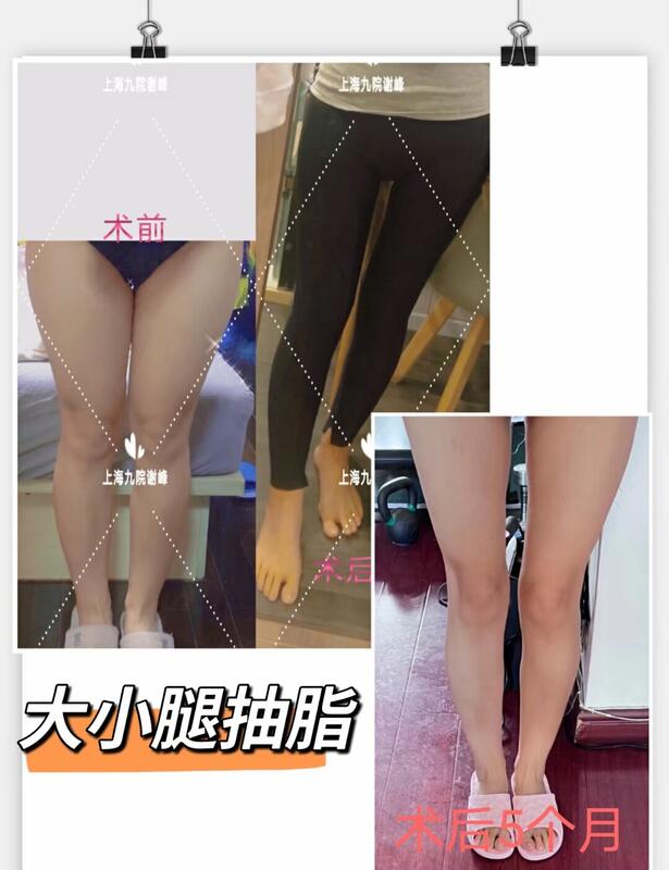 圖文圖片